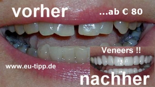 Zahnbehandlung in Tschechien - günstiger als Ungarn!! - Wellness Gesundheit - 